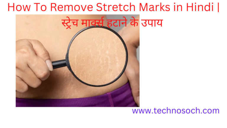 How To Remove Stretch Marks in Hindi-technosoch.com-